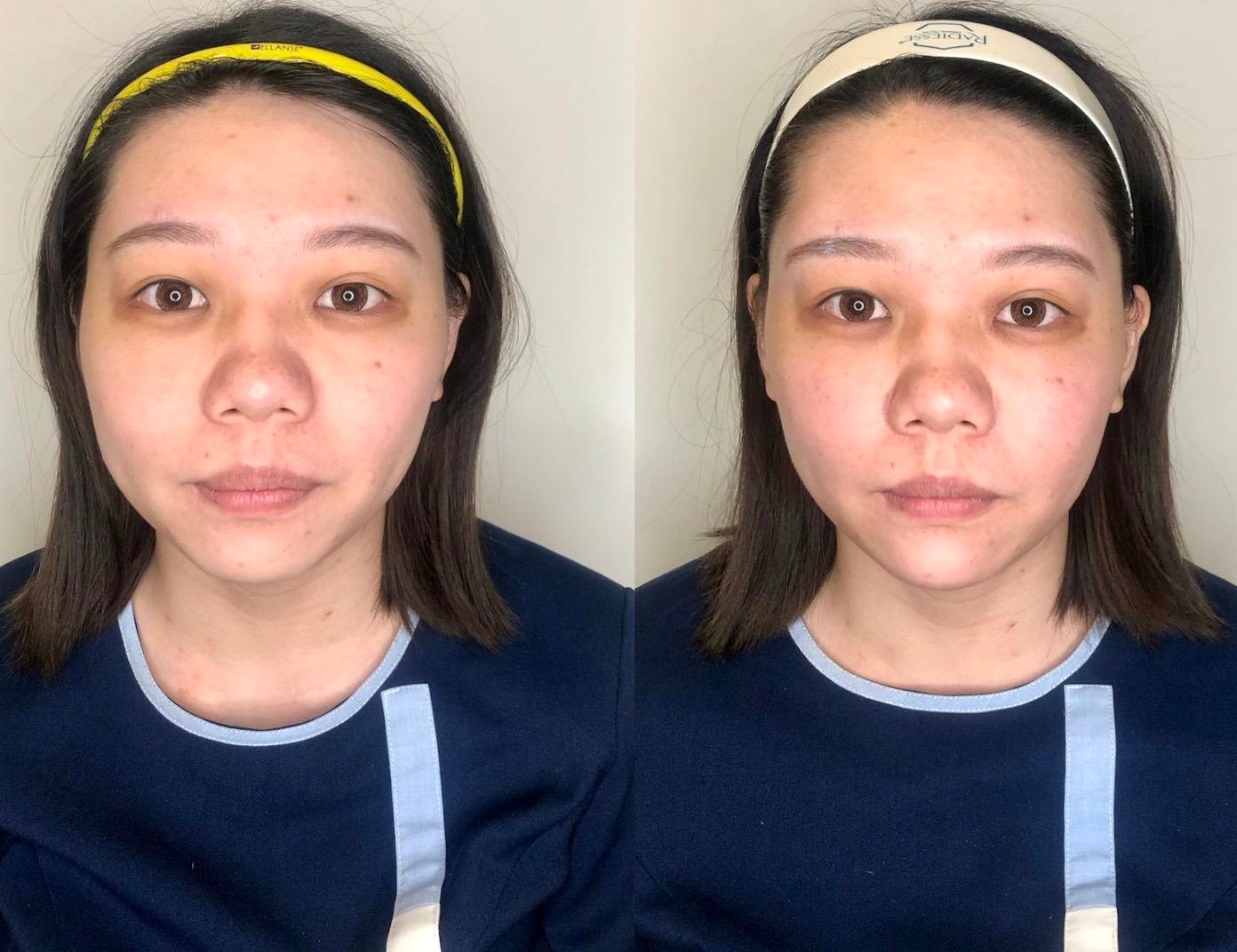 Read more about the article 晶亮瓷骨架支撐案例